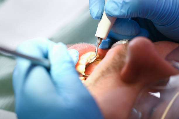 Best Emergency Dental Extractions in Harlan, IA